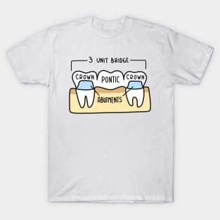 Hand Drawn Labeled Dental Bridge T-Shirt